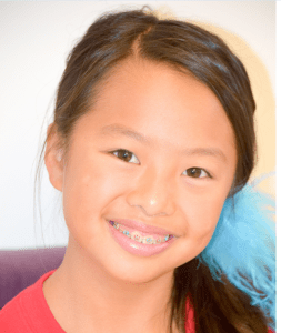 Photo of smiling girl with dental braces