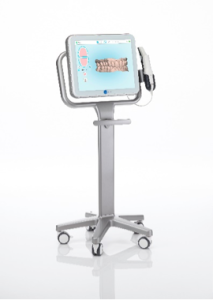 iTero intra-oral digital scanner on a pole